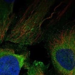 BAI2 Rabbit anti-Human, Polyclonal, Novus Biologicals:Antibodies:Primary