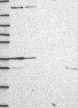 BAI2 Rabbit anti-Human, Polyclonal, Novus Biologicals:Antibodies:Primary
