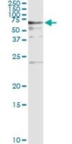BAIAP2 Antibody (3F3-2D3), Novus Biologicals 0.1 mg | Buy Online | Novus Biologicals | Fisher Scientific