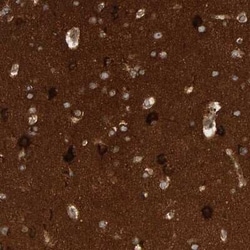 BAIAP2 Antibody, Novus Biologicals 0.1 mL | Buy Online | Novus Biologicals | Fisher Scientific