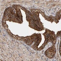 BAIAP2 Antibody, Novus Biologicals 0.1 mL | Buy Online | Novus Biologicals | Fisher Scientific