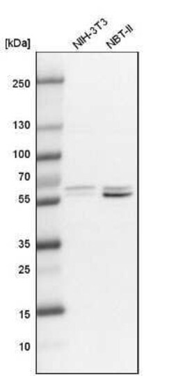 BAIAP2 Antibody, Novus Biologicals 25 &mu;L; Unconjugated:Antibodies, Polyclonal