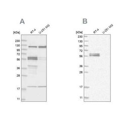 BAIAP2 Antibody, Novus Biologicals 25 &mu;L; Unconjugated:Antibodies, Polyclonal
