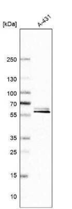 BAIAP2 Antibody, Novus Biologicals 0.1 mL | Buy Online | Novus Biologicals | Fisher Scientific