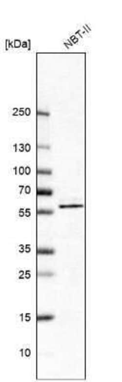 BAIAP2 Antibody, Novus Biologicals 0.1 mL | Buy Online | Novus Biologicals | Fisher Scientific