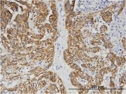 BAIAP2L1 Antibody (4A7), Novus Biologicals 0.1 mg | Buy Online | Novus Biologicals | Fisher Scientific
