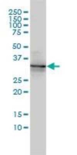 Novus Biologicals BAMBI/NMA Antibody (3C1-1D1), Novus Biologicals 0.1 mg | Buy Online | Novus Biologicals&trade; | Fisher Scientific