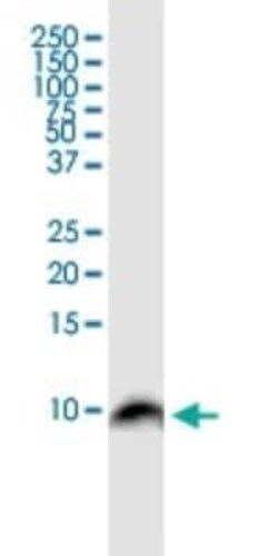 BANF1 Antibody (M2), Novus Biologicals 0.1 mg | Buy Online | Novus Biologicals | Fisher Scientific