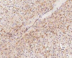 BAP28 Antibody, Novus Biologicals:Antibodies:Primary Antibodies