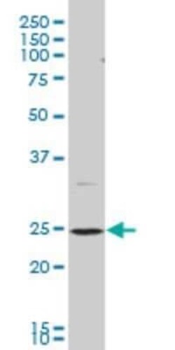 BAP29 Antibody (4B10), Novus Biologicals 0.1 mg | Buy Online | Novus Biologicals | Fisher Scientific