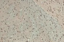 BARD1 Antibody, Novus Biologicals 100 &mu;g | Buy Online | Novus Biologicals | Fisher Scientific