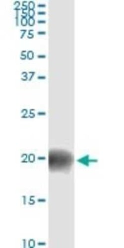 BATF Antibody (8A12), Novus Biologicals 0.1 mg | Buy Online | Novus Biologicals | Fisher Scientific