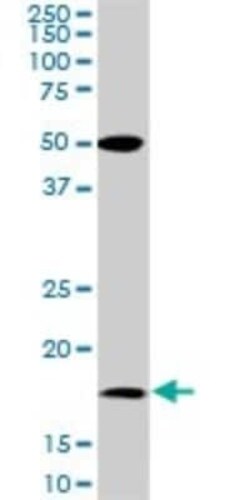 BATF Antibody (8A12), Novus Biologicals 0.1 mg | Buy Online | Novus Biologicals | Fisher Scientific