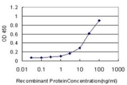 BBOX1 Antibody (6H3), Novus Biologicals 0.1 mg | Buy Online | Novus Biologicals | Fisher Scientific