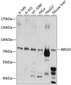 BBS10 Antibody - BSA Free, Novus Biologicals:Antibodies:Primary Antibodies