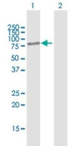 BBS2 Antibody, Novus Biologicals 0.05 mg | Buy Online | Novus Biologicals | Fisher Scientific