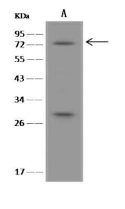 BBS2 Antibody, Novus Biologicals:Antibodies:Primary Antibodies