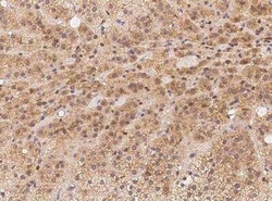 BBS9 Antibody, Novus Biologicals:Antibodies:Primary Antibodies