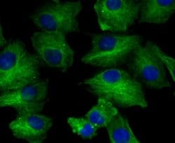 BCAP31 Antibody (JG37-81), Novus Biologicals 100 &mu;l; Unconjugated:Antibodies,
