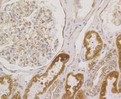 BCAP31 Antibody (JG37-81), Novus Biologicals 100 &mu;l; Unconjugated:Antibodies,