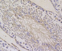 BCAP31 Antibody (JG37-81), Novus Biologicals 100 &mu;l; Unconjugated:Antibodies,