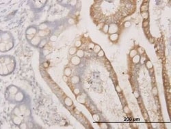 BCAS1 Antibody (1B5), Novus Biologicals 0.1 mg | Buy Online | Novus Biologicals | Fisher Scientific