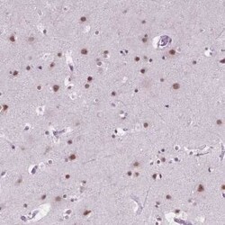 BCAS2 Antibody, Novus Biologicals 25 &mu;L, Unconjugated:Antibodies, Polyclonal