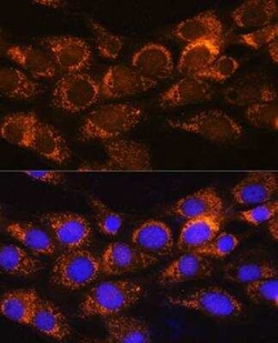 BCKDHA Antibody - BSA Free, Novus Biologicals 0.1 mL, Unconjugated:Antibodies,
