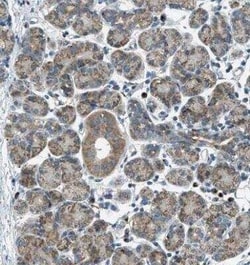 BCKDK Antibody, Novus Biologicals 0.1 mL; Unconjugated:Antibodies, Polyclonal