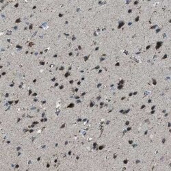 BCKDK Antibody, Novus Biologicals 0.1 mL; Unconjugated:Antibodies, Polyclonal