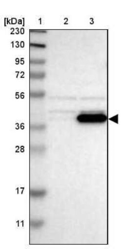 BCKDK Antibody, Novus Biologicals 0.1 mL; Unconjugated:Antibodies, Polyclonal