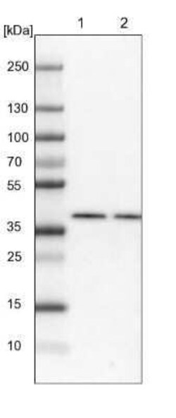 BCKDK Antibody, Novus Biologicals 0.1 mL; Unconjugated:Antibodies, Polyclonal