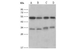 BCKDK Antibody, Novus Biologicals:Antibodies:Primary Antibodies