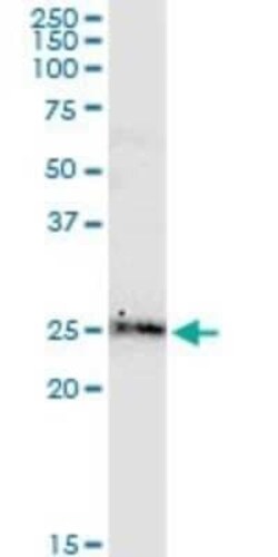 BCL-W/BCL2L2 Antibody (2E4), Novus Biologicals 0.1 mg | Buy Online | Novus Biologicals | Fisher Scientific