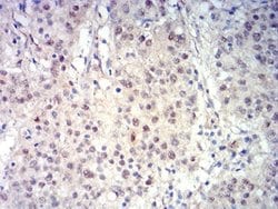 BCL11B Antibody (1F8G8) - BSA Free, Novus Biologicals 0.1 ml; Unconjugated:Antibodies,
