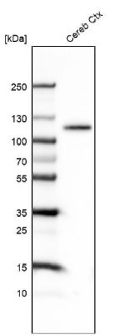 BCL11B Antibody (CL6426), Novus Biologicals:Antibodies:Primary Antibodies