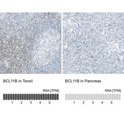 BCL11B Antibody (CL6426), Novus Biologicals:Antibodies:Primary Antibodies