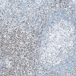 BCL11B Antibody (CL6426), Novus Biologicals:Antibodies:Primary Antibodies