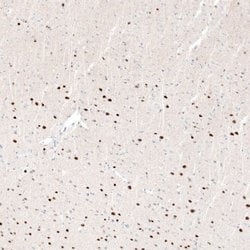 BCL11B Antibody (CL6426), Novus Biologicals:Antibodies:Primary Antibodies