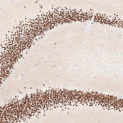 BCL11B Antibody (CL6426), Novus Biologicals:Antibodies:Primary Antibodies