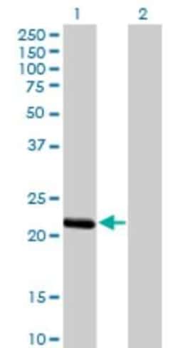 Novus Biologicals BCL2L10 Antibody (1B11), Novus Biologicals 0.1 mg | Buy Online | Novus Biologicals&trade; | Fisher Scientific