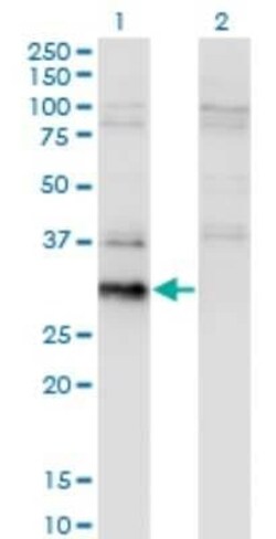 BCL7B Antibody (4G1), Novus Biologicals 0.1 mg | Buy Online | Novus Biologicals | Fisher Scientific