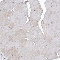 BDH2 Antibody, Novus Biologicals 0.1 mL; Unconjugated:Antibodies, Polyclonal