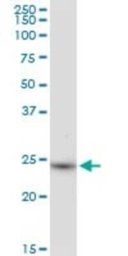 BDH2 Antibody, Novus Biologicals 50 &mu;g | Buy Online | Novus Biologicals | Fisher Scientific