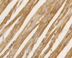 BDNF Rabbit anti-Human, Clone: SJ12-09, Novus Biologicals 100&mu;L:Antibodies,