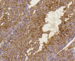 BDNF Rabbit anti-Human, Clone: SJ12-09, Novus Biologicals 100&mu;L:Antibodies,