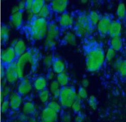 BDNF Rabbit anti-Human, Mouse, Rat, Polyclonal, Novus Biologicals 0.1 mg | Buy Online | Novus Biologicals | Fisher Scientific