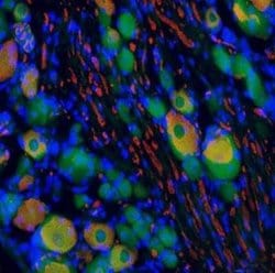 BDNF Rabbit anti-Human, Mouse, Rat, Polyclonal, Novus Biologicals 0.1 mg | Buy Online | Novus Biologicals | Fisher Scientific