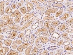 BEX4 Antibody, Novus Biologicals 100 &mu;g, Unconjugated:Antibodies, Polyclonal