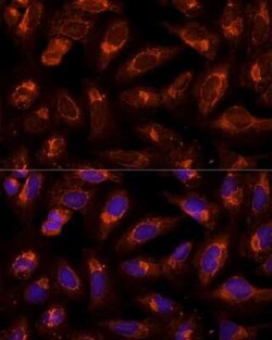 BFAR Antibody - BSA Free, Novus Biologicals:Antibodies:Primary Antibodies
